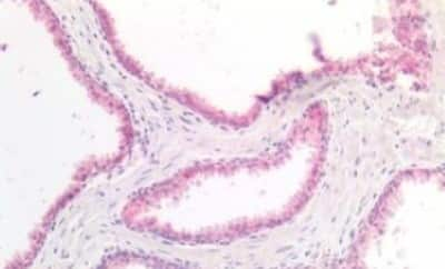 Immunohistochemistry-Paraffin: SRD5A1 Antibody [NBP3-14482] - Human Prostate: Formalin-Fixed, Paraffin-Embedded (FFPE)